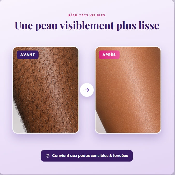 Crème épilatoire