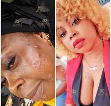 Crème Anti-Acné & Anti-Taches