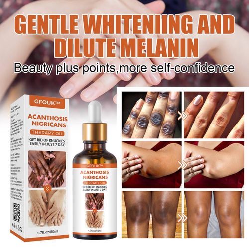 Dark Elbow and Knee Lightning Essence