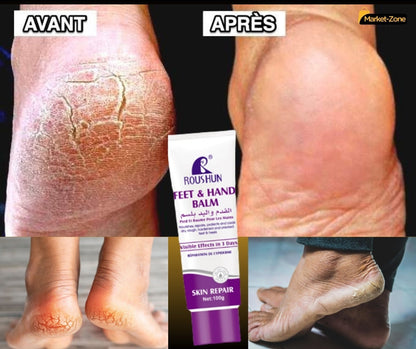 CREAM anti-fissures de Pieds et les mains durs