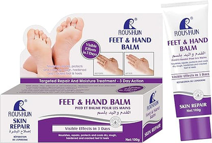 CREAM anti-fissures de Pieds et les mains durs