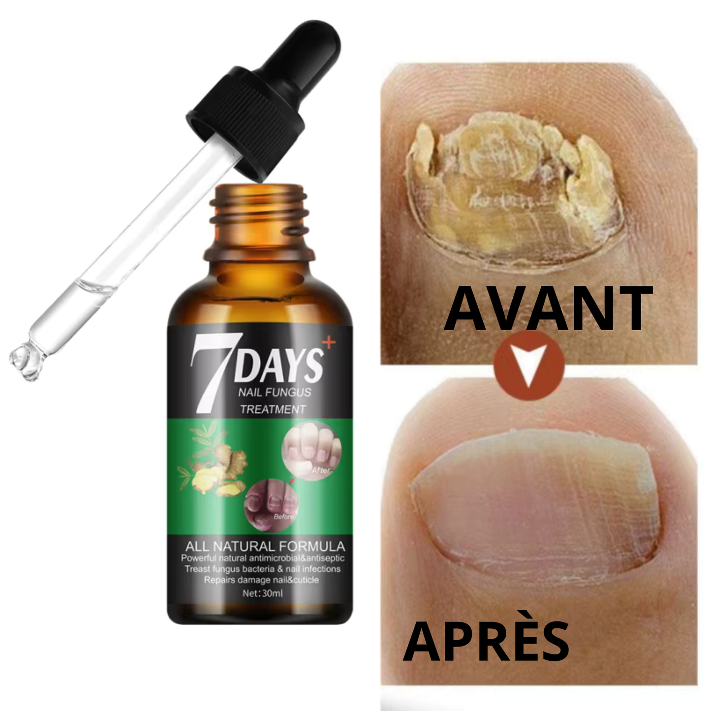 sérum antifongique pour les ongles