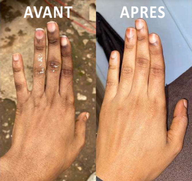 CLEAN™: Gel Exfoliant Purifiant - Teint Unifie & Peau Lisse