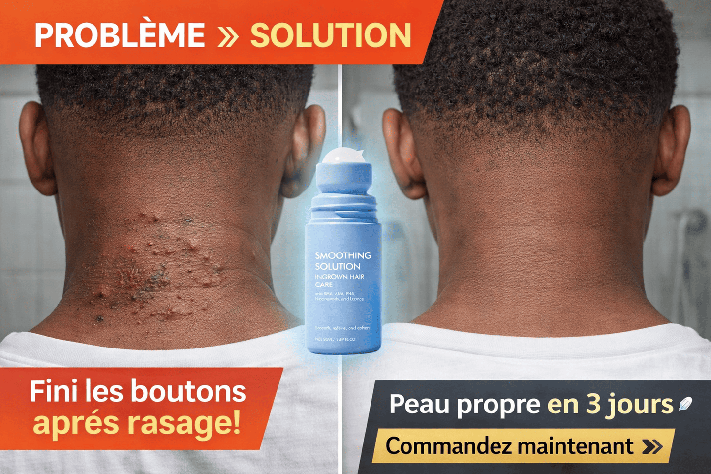 Crème Anti-Boutons Après Rasage