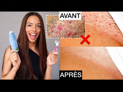Crème Anti-Boutons Après Rasage