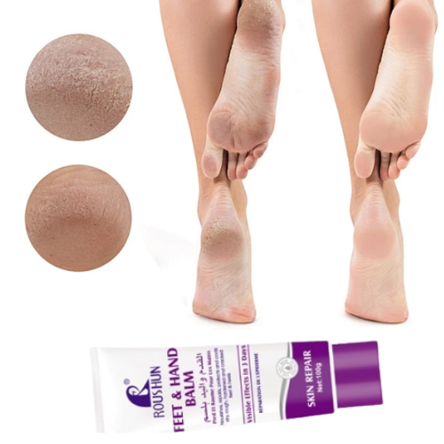 CREAM anti-fissures de Pieds et les mains durs