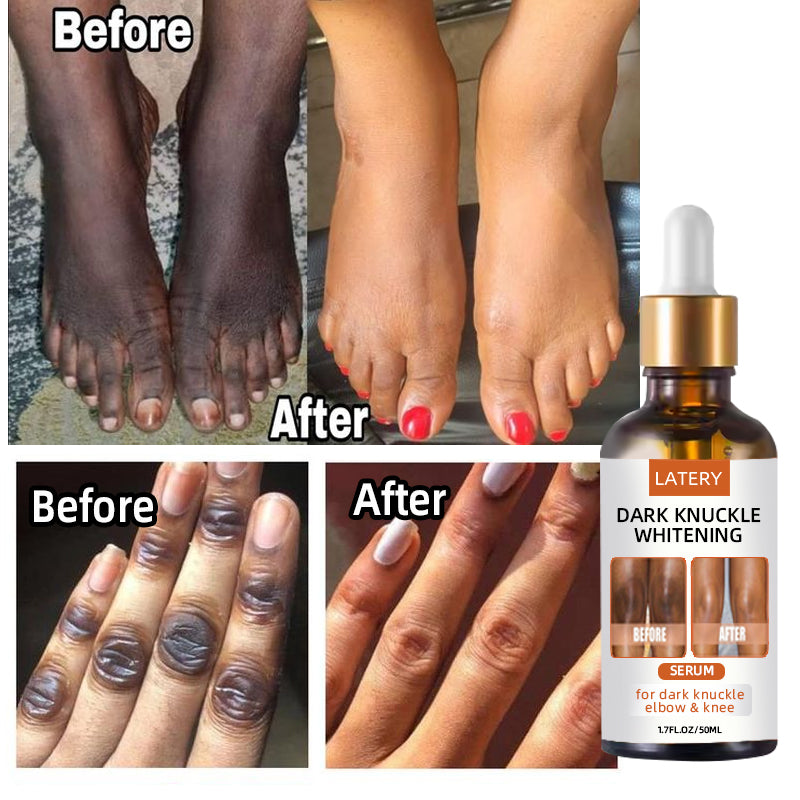 Dark Elbow and Knee Lightning Essence