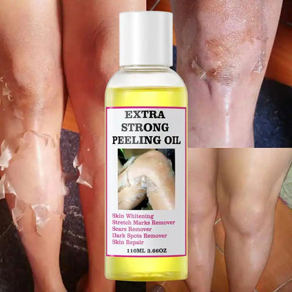 Peeling Oil, Huile Peeling Pour Le Corps