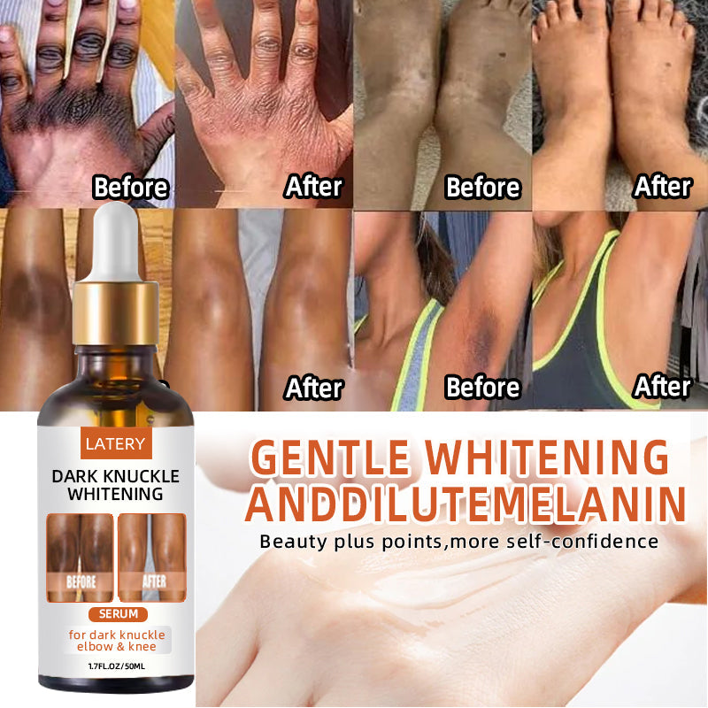 Dark Elbow and Knee Lightning Essence