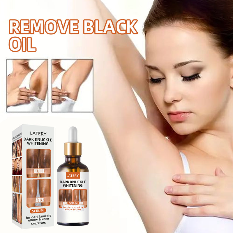 Dark Elbow and Knee Lightning Essence