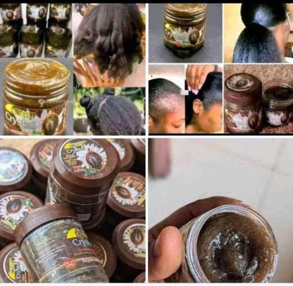 HAIR RENAISSANCE™: Crème De Repousse Cheveux