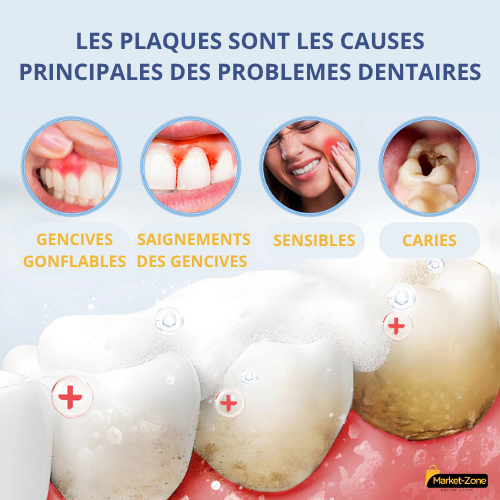 B-ACCEL™: Le Dentifrice Ultra Blanchissant A la Niacinamide (Résultat prouvé)